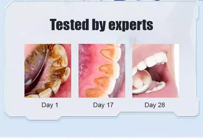 Whitening Toothpaste