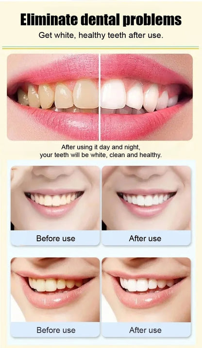 Whitening Toothpaste