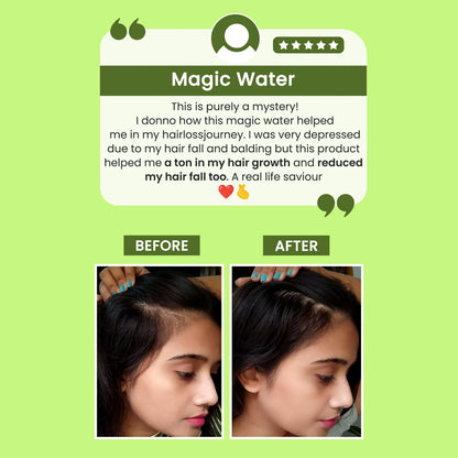 🌿 Rosemary Water Hair Spray for Regrowth | Buy 1 Get 3 (Pack of 3 and 6)