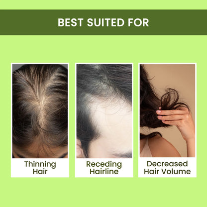 🌿 Rosemary Water Hair Spray for Regrowth | Buy 1 Get 3 (Pack of 3 and 6)